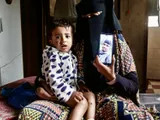 Gaza toddler released from Israeli custody with 'cigarette burn' wounds